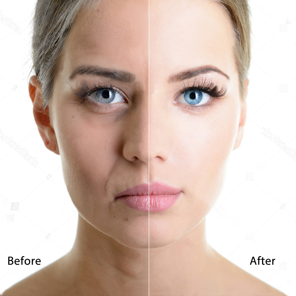 Ultrasonic Face Skin Scrubber Facial